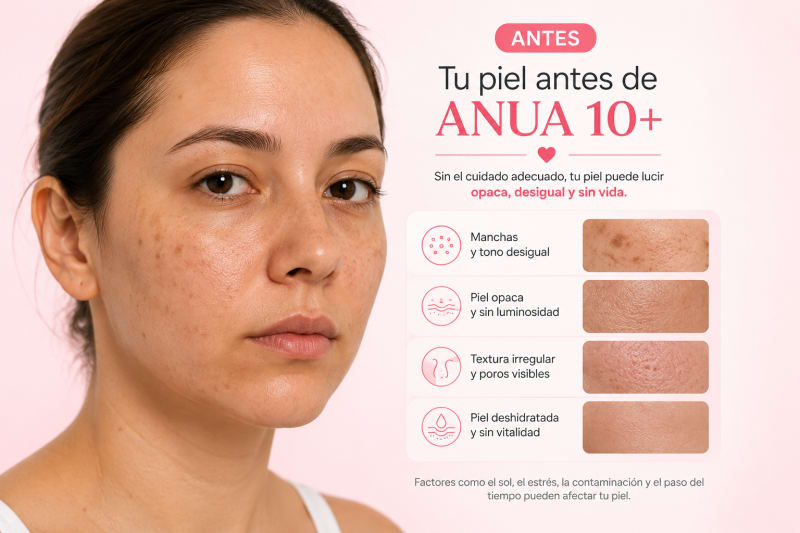 Antes