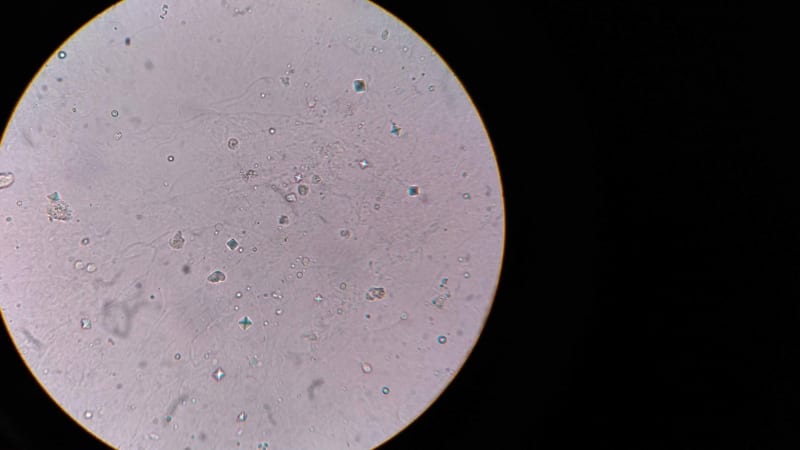Breakthrough in Fertility: Scientists Engineer Functional Precursors to Sperm in Lab-Grown Testes