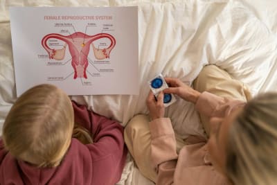 Unraveling Polycystic Ovary Syndrome: A Complex Hormonal Disorder Affecting Millions