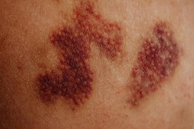 Visible Hand Discoloration Fuels New Health Speculation Ahead of Medical Examination