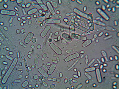 Organized microbial ‘workforces’ keep Earth’s underground biosphere running