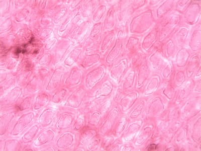 Immunotherapy Innovations: Increasing Survival in Metastatic Breast Cancer