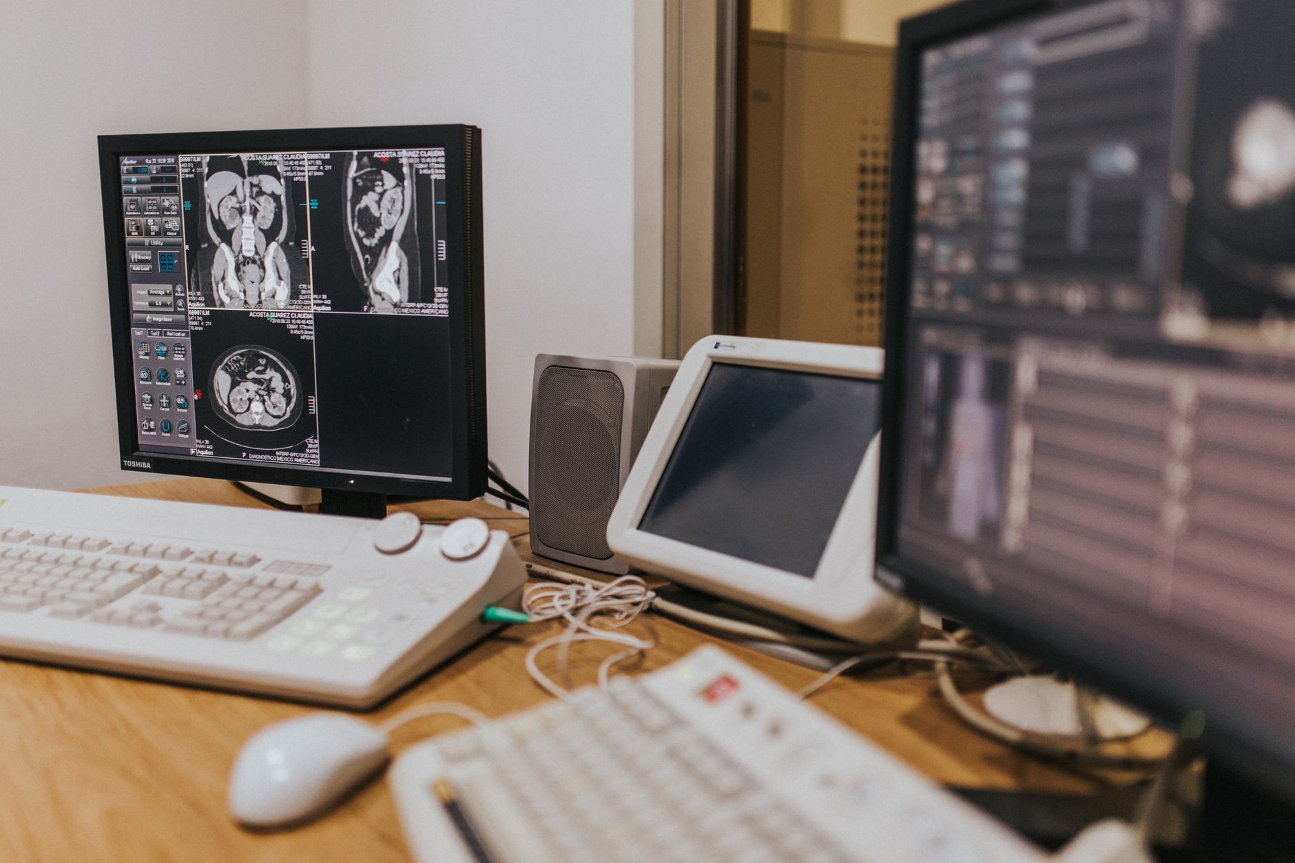 Unraveling the Viral Link: Epstein-Barr's Alarming Role in Multiple Sclerosis Development