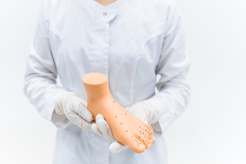 Southwest Florida Pioneers Revolutionize Bunion Surgery with Advanced Techniques