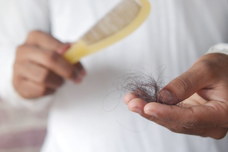 What a hair loss breakthrough could mean for women like me
