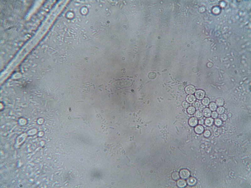 Groundbreaking Cellular Mechanism Unveiled: Paving the Way for a New Era in Cancer Therapeutics