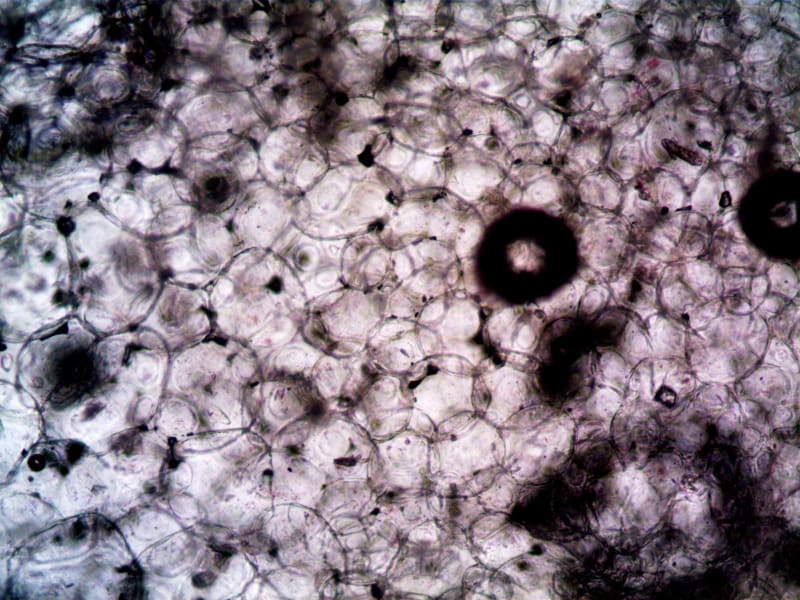 Revolutionary Melanoma Risk Stratification Test Earns FDA Breakthrough Designation, Promising Earlier Intervention