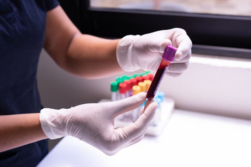 Groundbreaking Blood Test Identifies Dementia Risk Decades Before Cognitive Decline