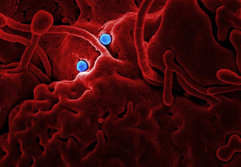 Revolutionary Drug Candidate Targets Gut Health to Combat Severe Fatty Liver Disease