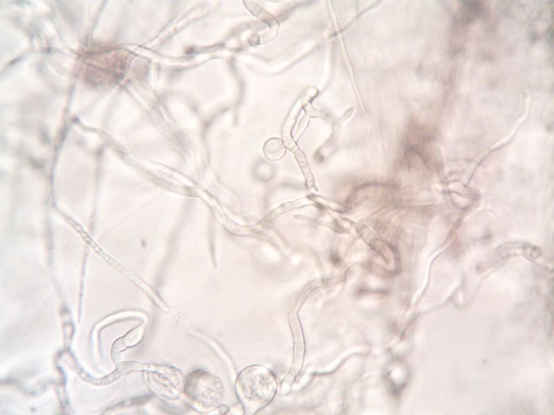 Revolutionary Sodium Channel Blockers: A New Era of Non-Opioid Pain Management Emerges