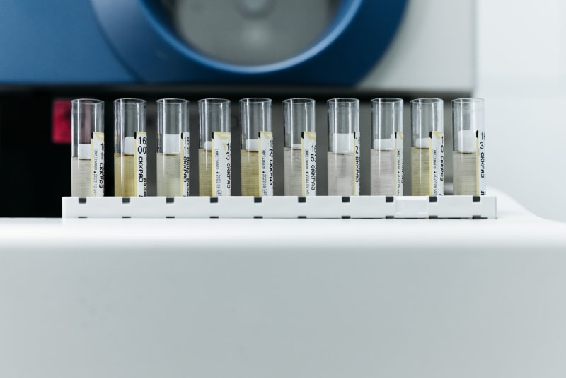 Revolutionary Urine Test Secures FDA Breakthrough Status, Promising Earlier Multi-Cancer Detection