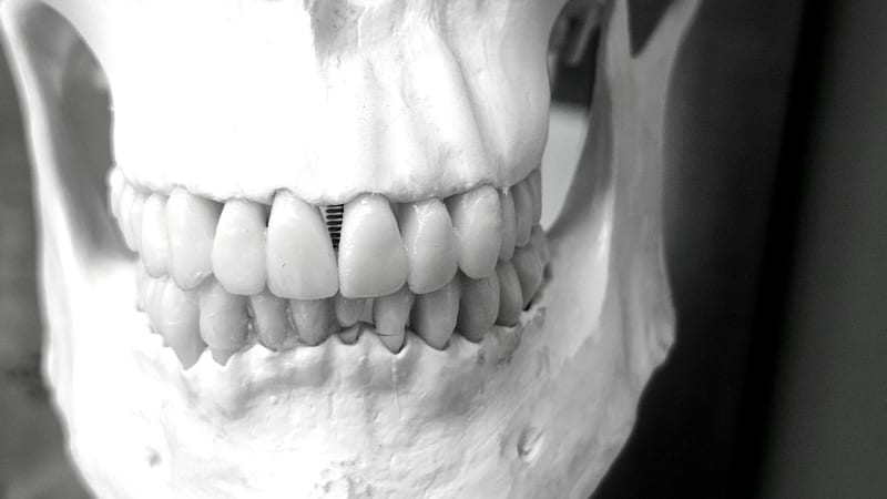 Unlocking Bone Health: New Genomic Atlas Pinpoints Hundreds of Crucial Genes