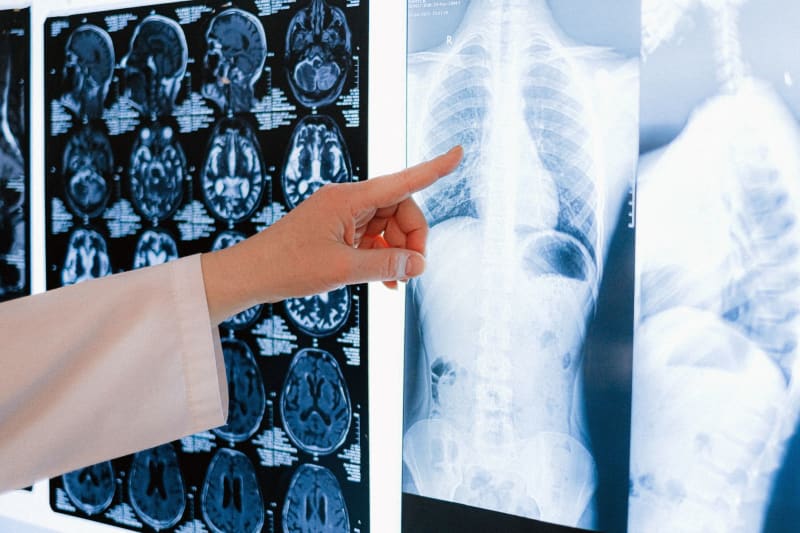 Revolutionary MRI Technology Unlocks Unprecedented Detail of Brain and Ocular Structures