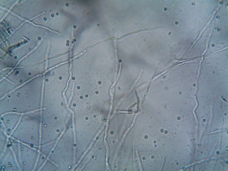 Groundbreaking Experimental Drug Repairs Gut, Completely Reverses Severe Fatty Liver Disease
