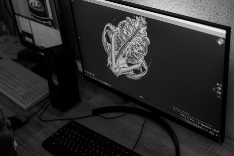 Unlocking the Skeleton's Secrets: New Genomic Map Pinpoints Hundreds of Bone Health Genes