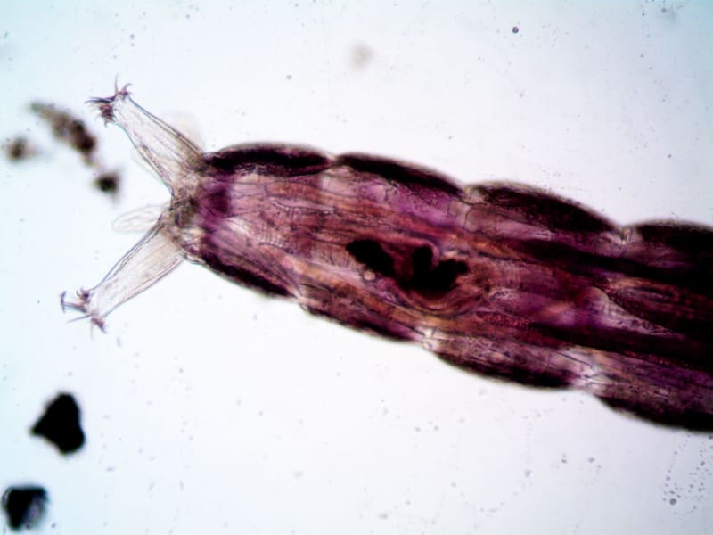 Cryptosporidium Crisis: Over 1,000 Cases Confirmed in Alarming Diarrhea Outbreak