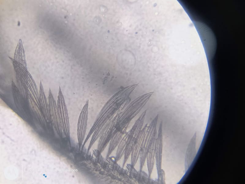 Michigan's Cyclospora Crisis Deepens: Urgent Action Needed as Cases Skyrocket Across State