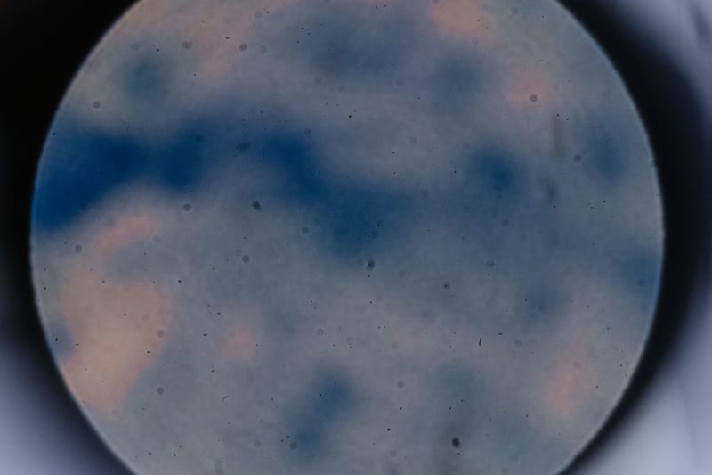 Unveiling the Eye's Secret Weapon: A Newly Discovered Cellular Waste Disposal System