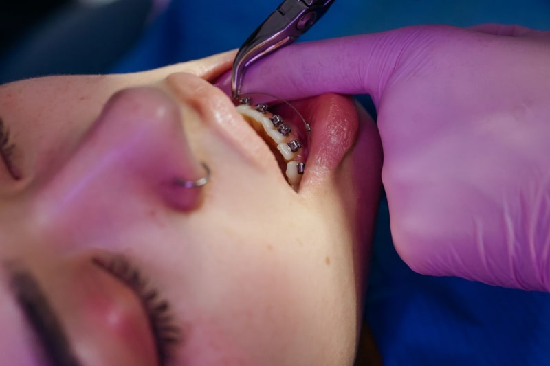 Revolutionary Gel Promises End to Fillings: Can We Finally Regrow Our Teeth?