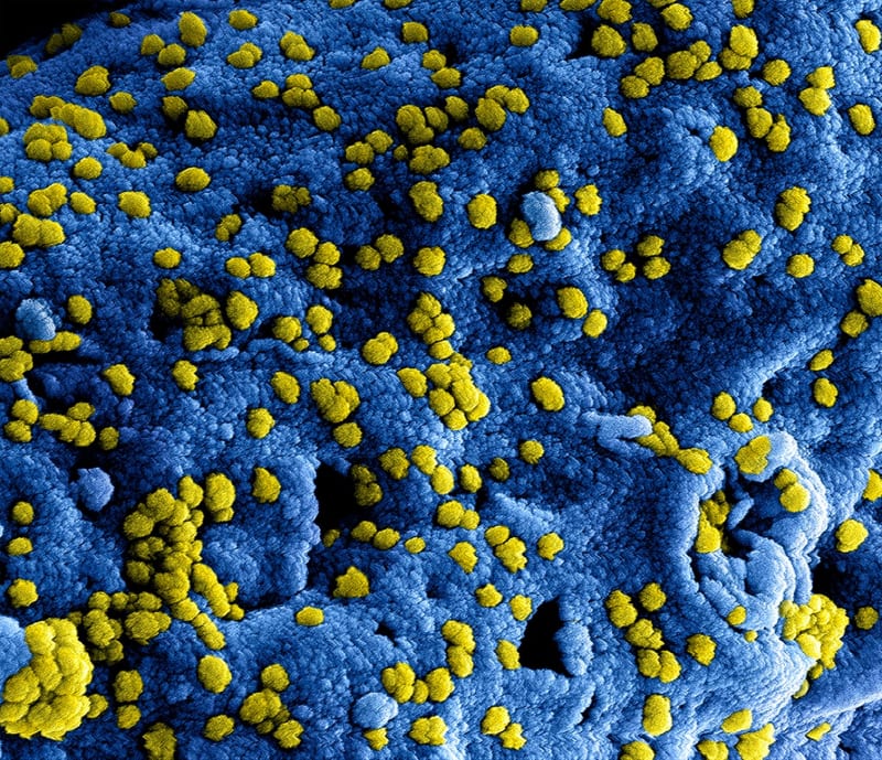 Global Health Emergency Declared: Ebola's Relentless Spread Threatens Regional Stability