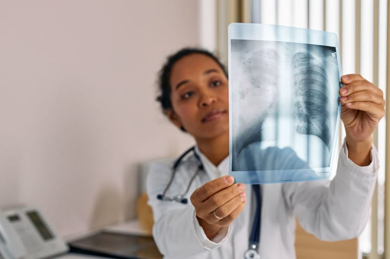 Unmasking the Silent Epidemic: Lung Cancer's Devastating Impact on Non-Smoking Women