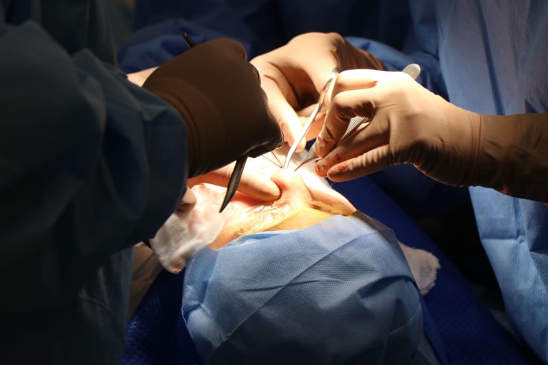 AI's Precision Strike: Johns Hopkins Surgeon Unveils Breakthrough in Early Pancreatic Cancer Detection