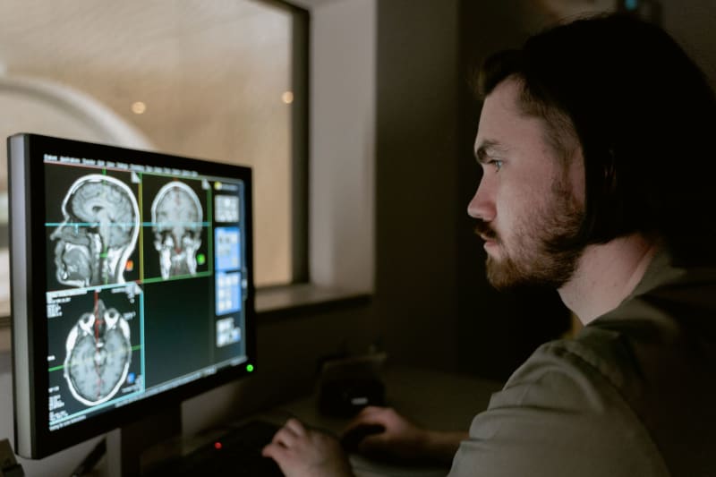 Revolutionary AI Detects Brain Hemorrhages Faster Than Humans, Promising Lifesaving Interventions