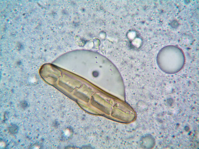 Cyclosporiasis Crisis Deepens: Michigan Outbreak Claims Two Lives, Health Officials Urge Vigilance