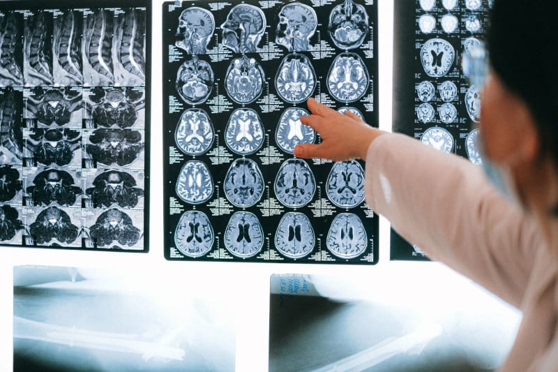 Unseen Cognitive Toll: Pandemic's Shadow Accelerates Brain Aging, Regardless of Infection Status