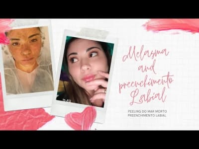 DICA PARA  CLAREAR MANCHAS/ MELASMA/DIARIO DO PEELING DO MAR MORTO/  PREENCHIMENTO LABIAL / MELASMA.
