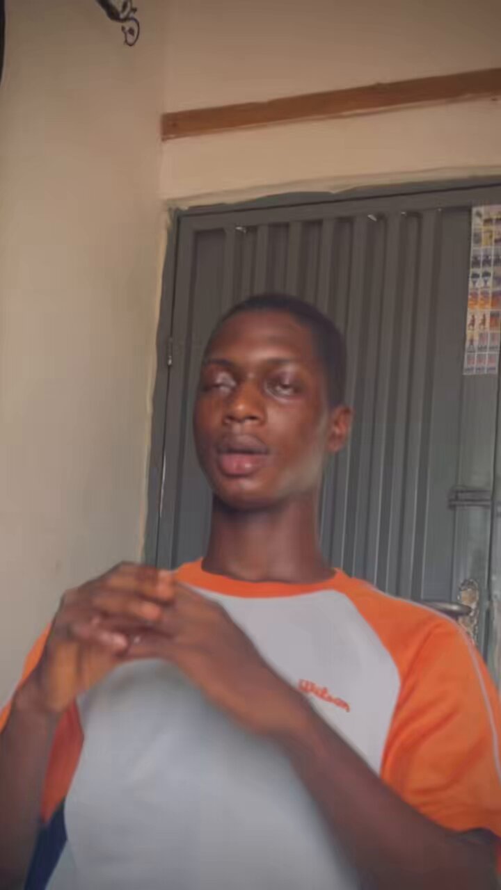 OG Image
