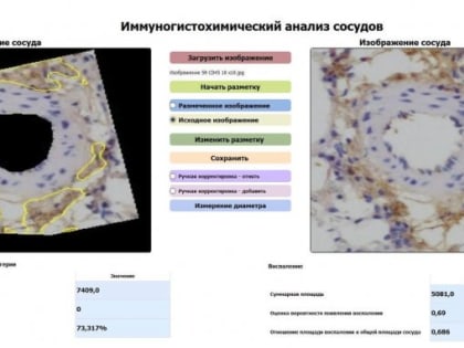 Ученые из Санкт-Петербурга создали новый препарат для лечения рака легких