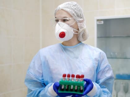 За сутки в Краснодарском крае выявили 381 случай заражения коронавирусом