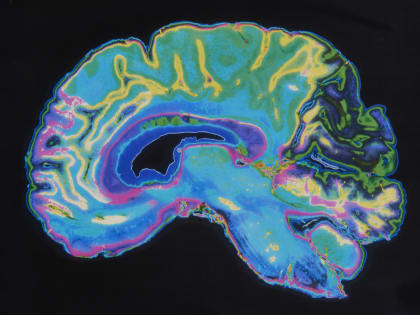 Компания Маска успешно вживила имплант в мозг человека