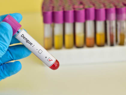 В Чите выявили первый за три года случай лихорадки денге