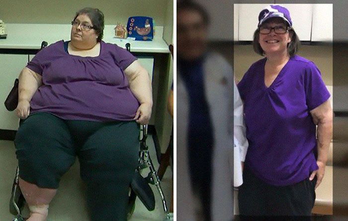avant-apres-pertes-poids-transformations-personnes-13.jpg