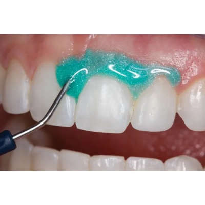 ΒΟΗΘΗΤΙΚΑ ΕΙΔΗ ΛΕΥΚΑΝΣΗΣ
