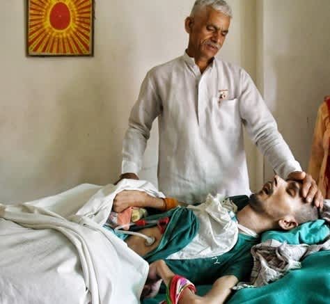 हरीश राणा केस: इच्छामृत्यु प्रक्रिया अंतिम चरण में