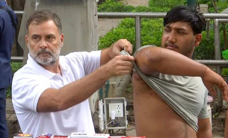CJP Protest पर राहुल गांधी का हमला, धर्मेंद्र प्रधान पर गंभीर आरोप