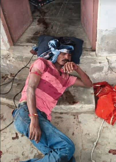 सोशल मीडिया विवाद में पाली के घर पर हमला, तीन लोग घायल