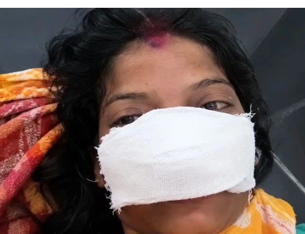 सीतापुर में पत्नी पर हमला, पति पर नाक काटने का आरोप