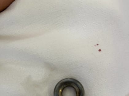 Юный пациент спасён от инородного тела в Балаково