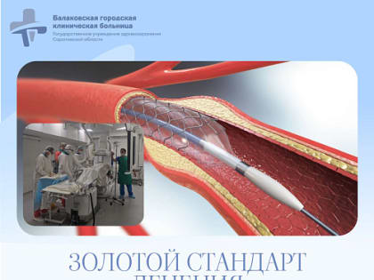 Балаковские врачи спасли жизнь пациенту с инфарктом