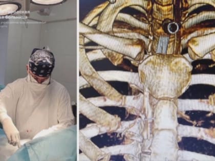 Отбиты органы, сломаны ребра. Саратовчанке сделали более десятка операций и спасли