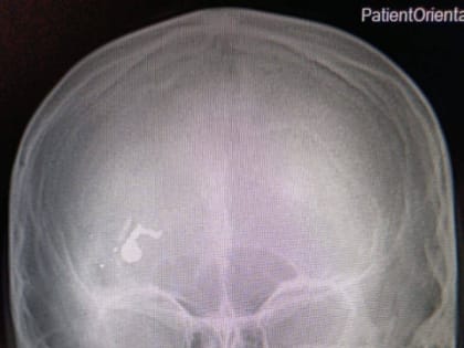 Трагедия в Саратовской области: ребенок пострадал при невыясненных обстоятельствах