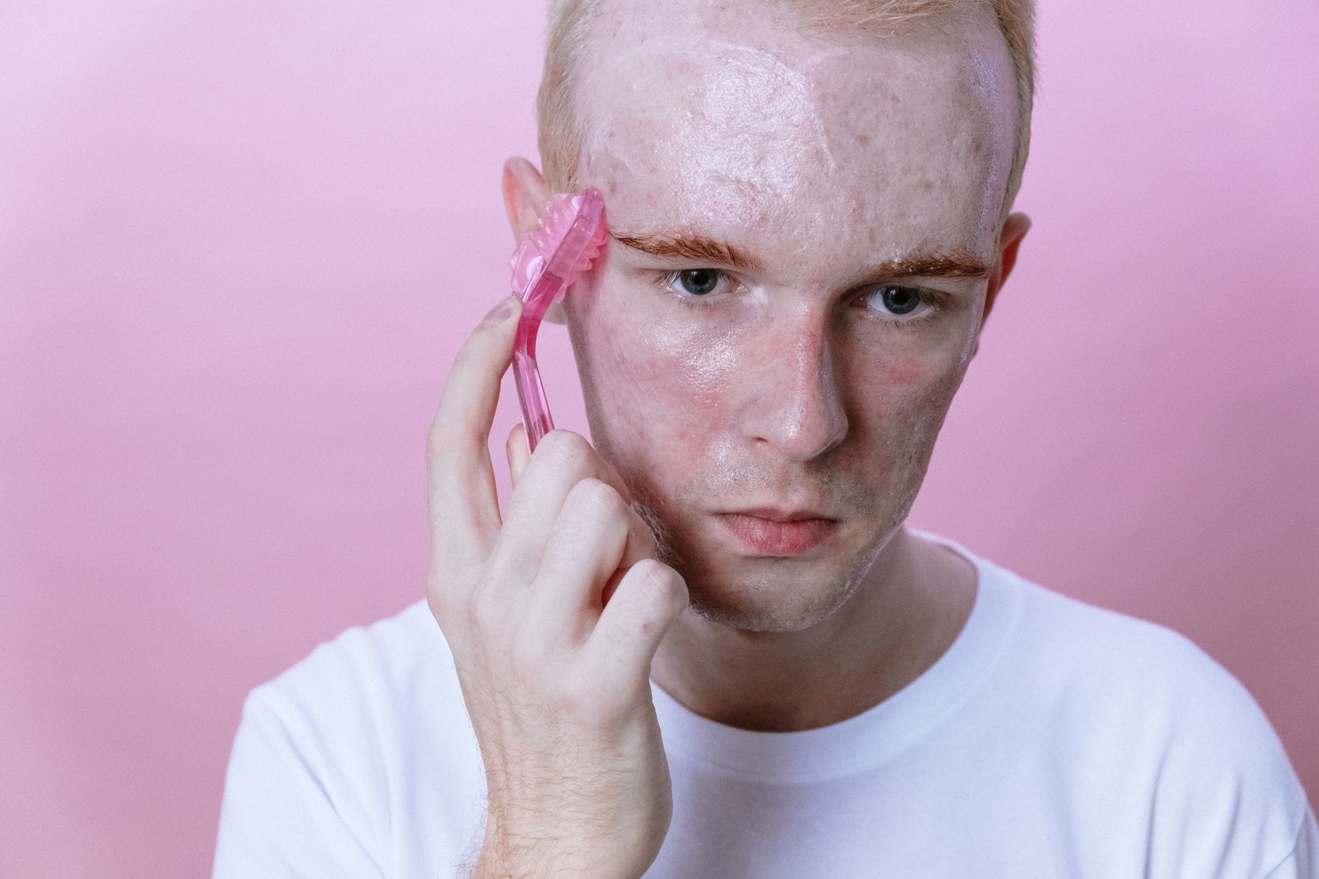 Acne due to your beard, prevent it this way