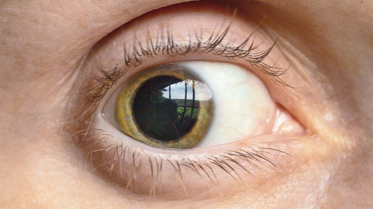 Why Do Pupils Dilate When Surprised Why Do Pupils Dilate When Surprised - pupil dilation