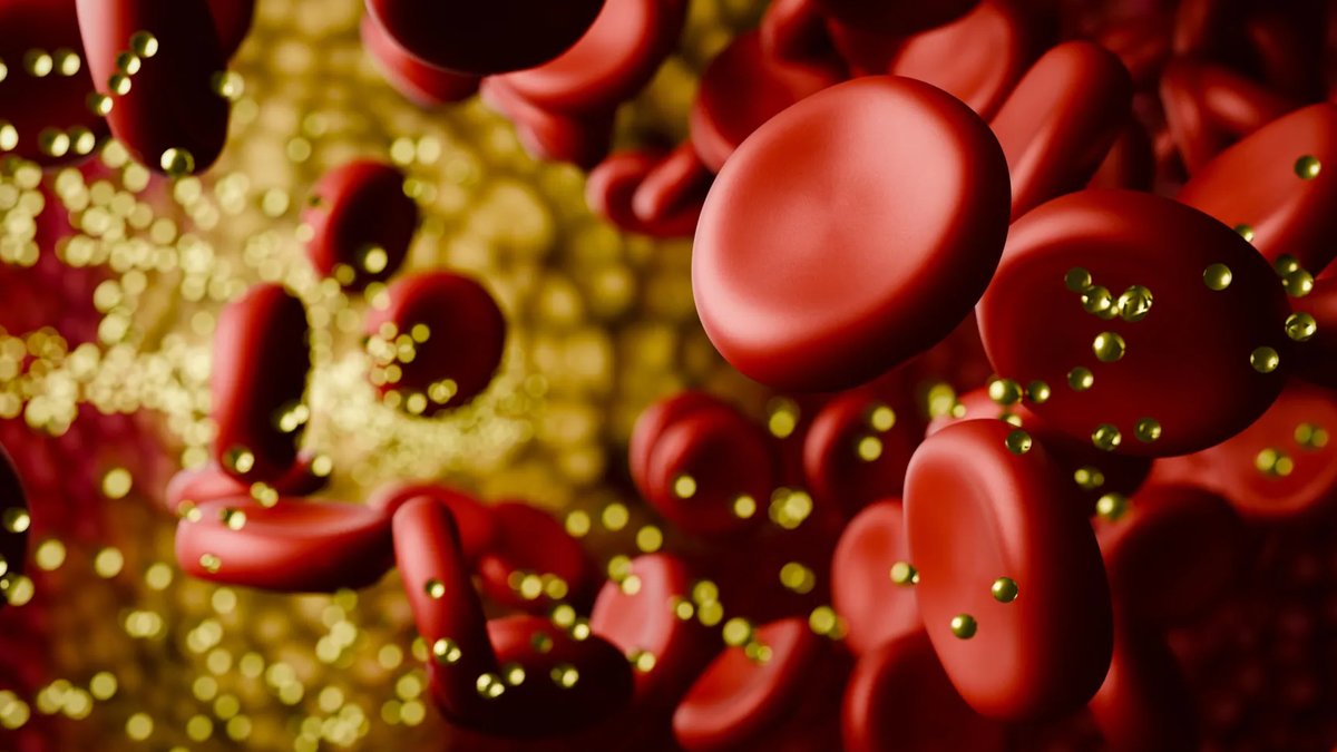 Genes may drive cholesterol spike on low-carb diets - low-carb diets