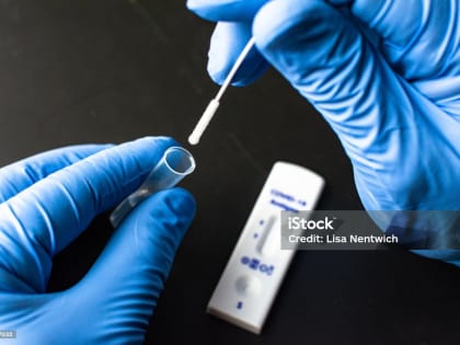 Мурашко оценил в десятки тысяч число россиян, зараженных коронавирусом