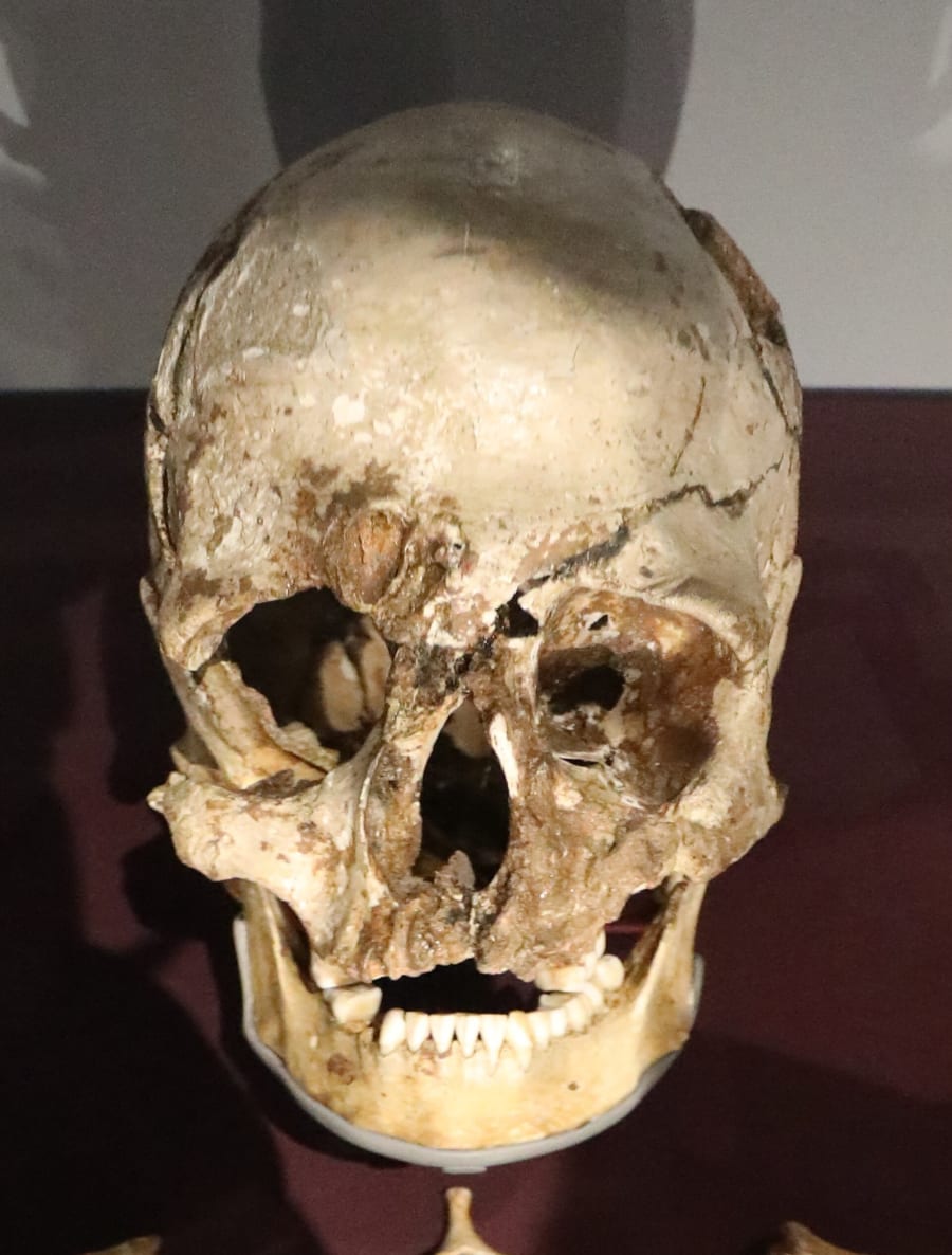 A brown, ancient human skull with its lower jaw, displayed in a museum case.